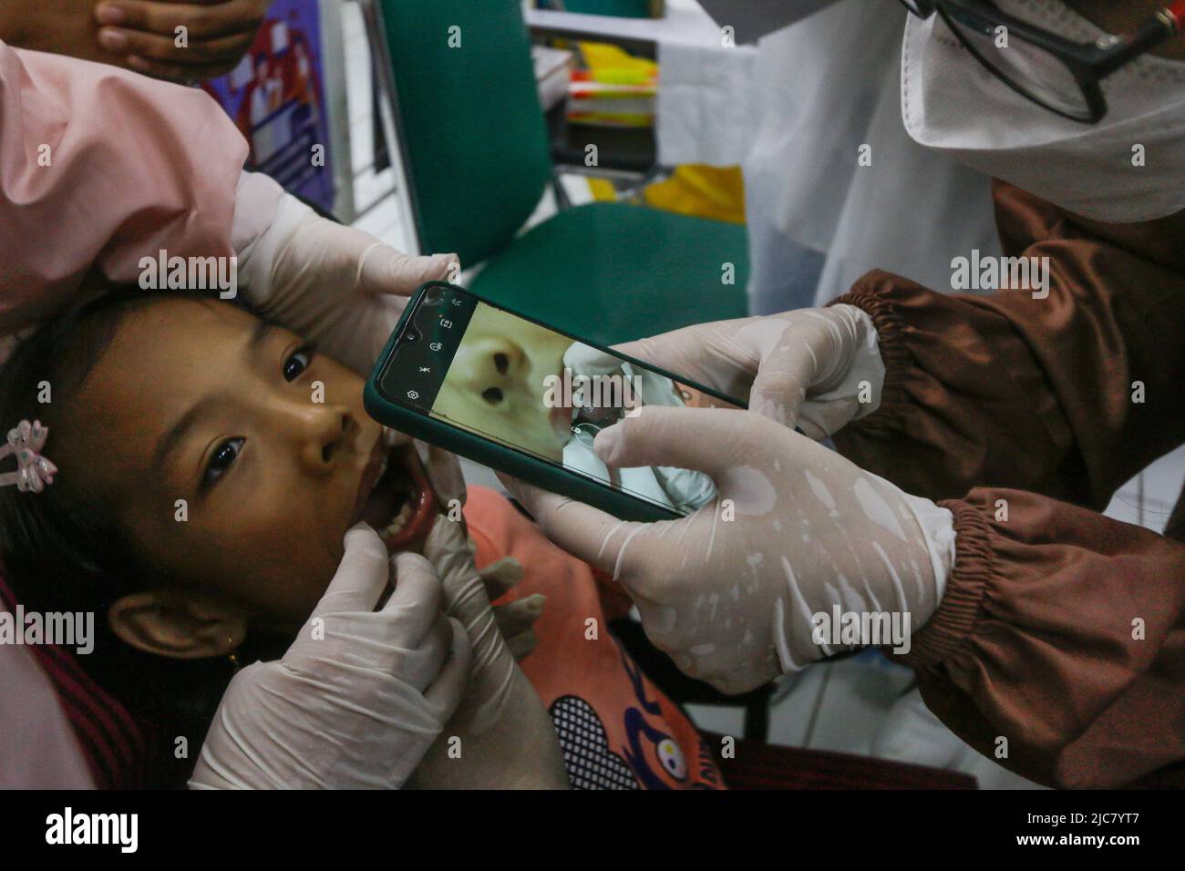 Dental and oral health checks for Cerebral Palsy children in Bogor City