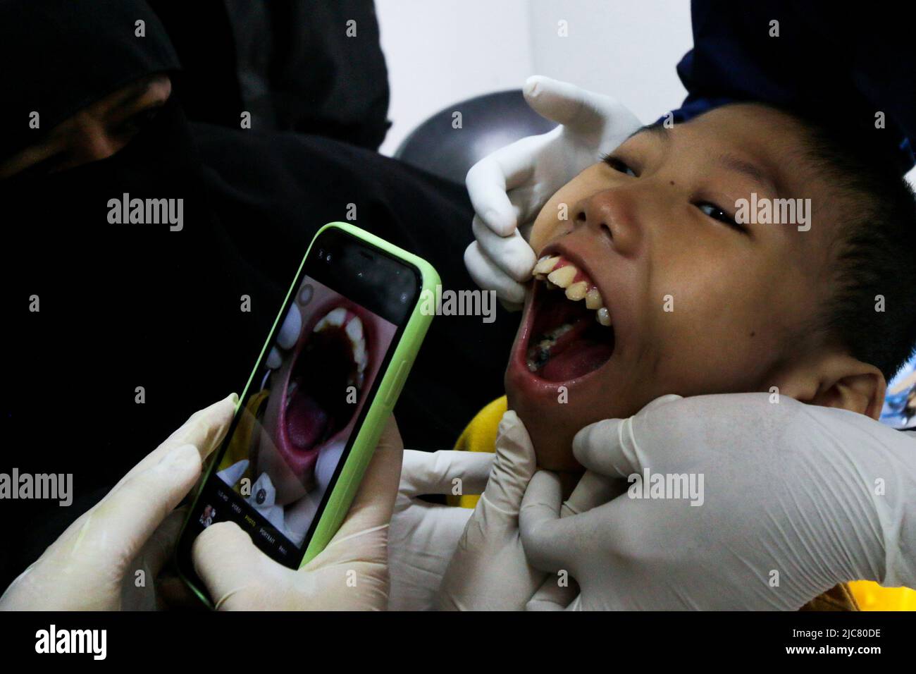 Dental and oral health checks for Cerebral Palsy children in Bogor City