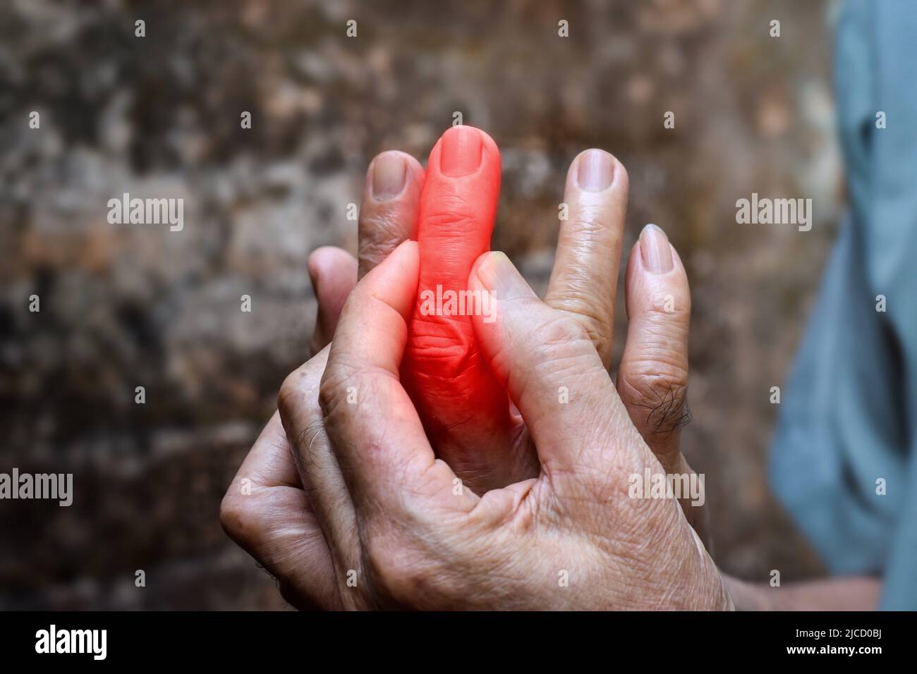 Inflammation of Asian old man middle finger and hand. Concept of cellulitis and finger problems. Stock Photo
