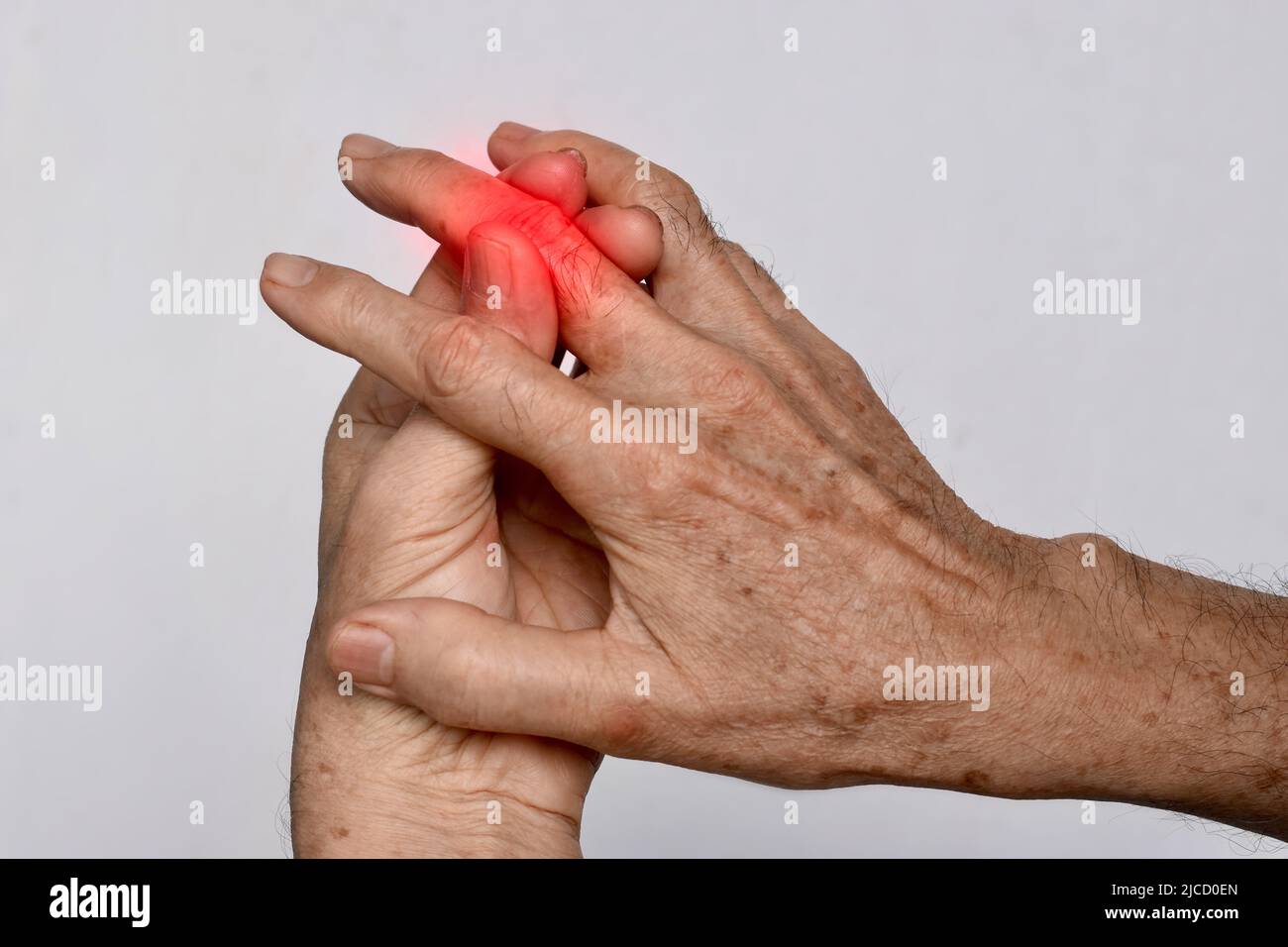 Inflammation of Asian old man middle finger and hand. Concept of arthritis or cellulitis. Stock Photo
