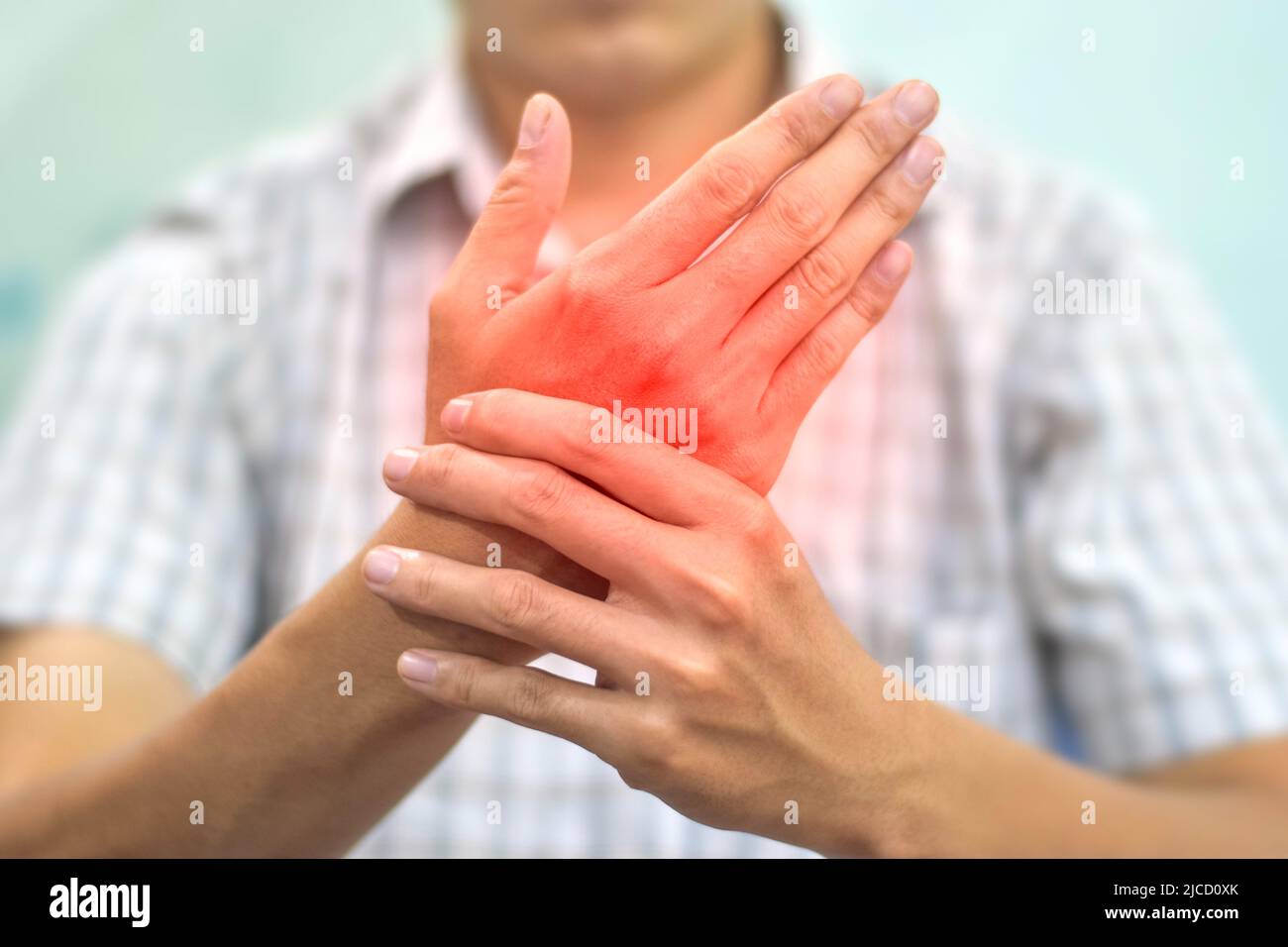 Hand joints inflammation. Concept and idea of rheumatic arthritis, gout, joint swelling or arthralgia. Stock Photo