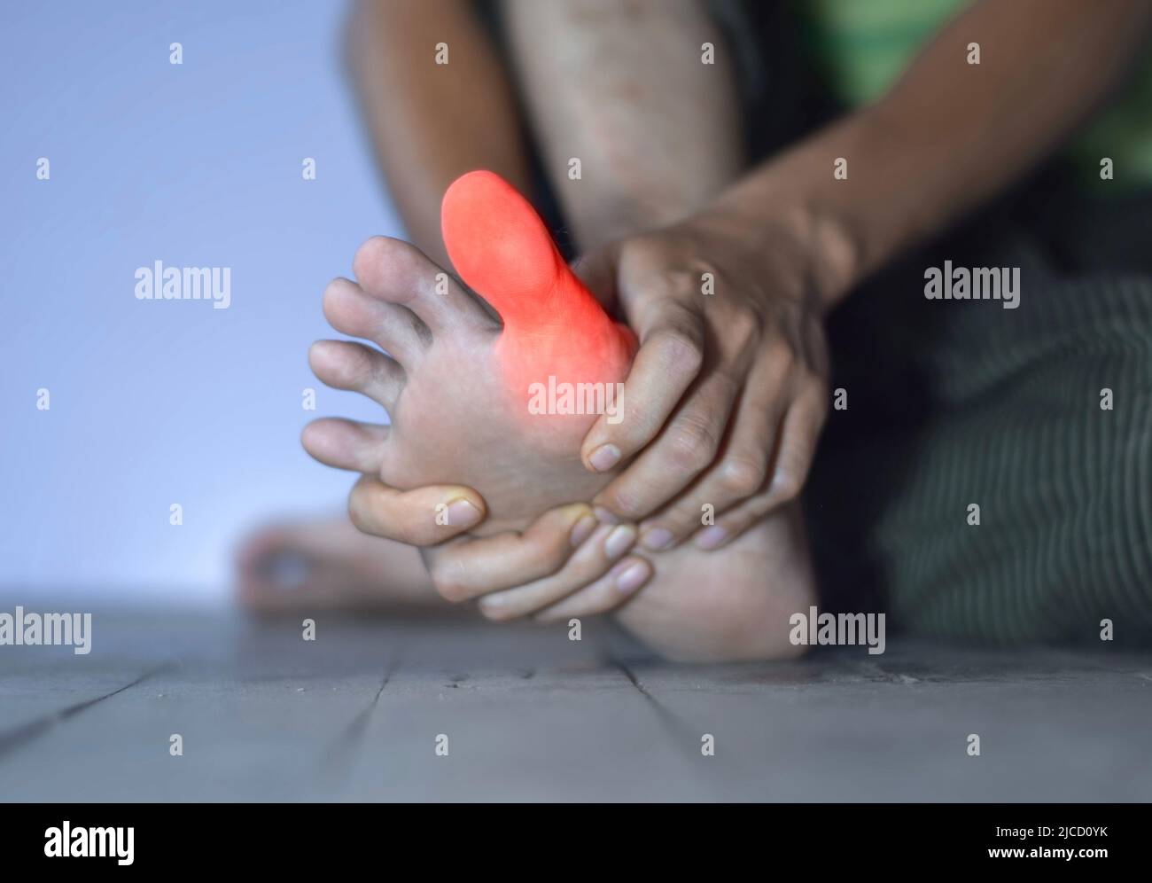 Inflammation of Asian young man’s big toe. Concept of foot joint pain, arthritis, stumble, hyperuricema or gout. Stock Photo