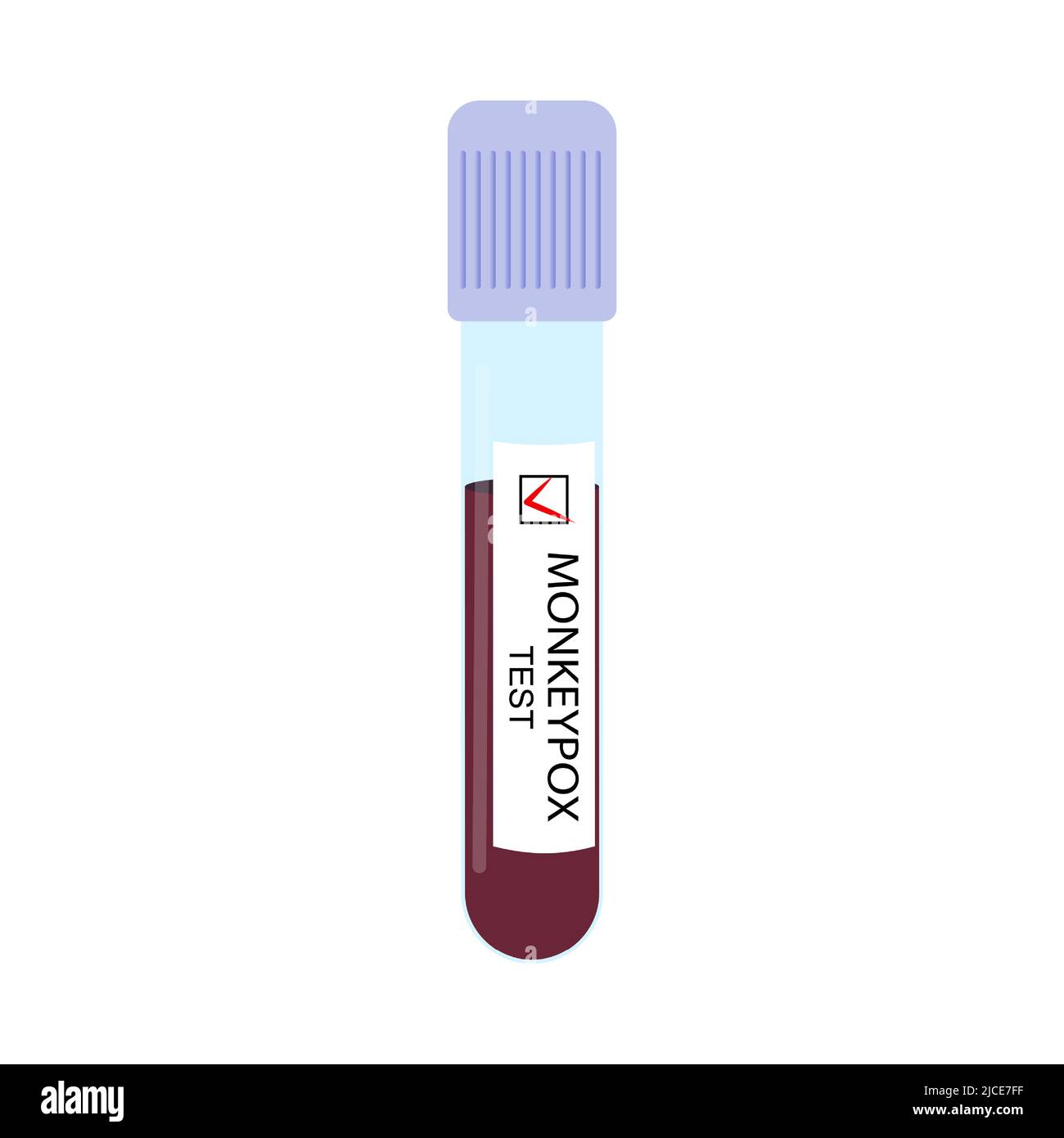 Test tube with a blood sample with a positive test for monkeypox virus ...
