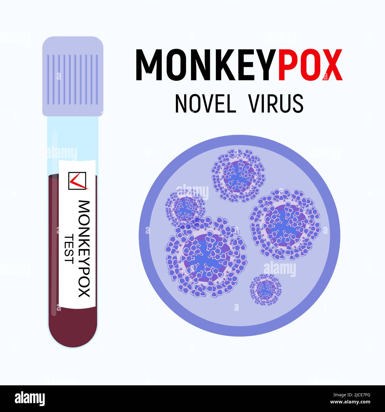 Test tube with a blood sample with a positive test for the monkeypox virus and viral cells close-up. Microbiological medical background. Vector Stock Vector