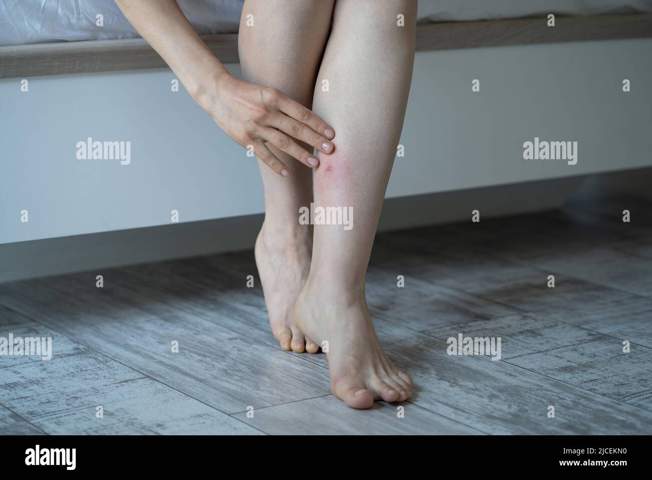 Asian female touches her leg after being bitten by mosquito at home suffering from allergic reaction Stock Photo