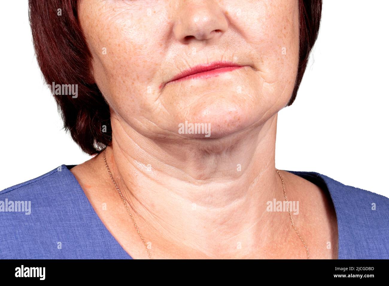 Sagging skin face hires stock photography and images Alamy
