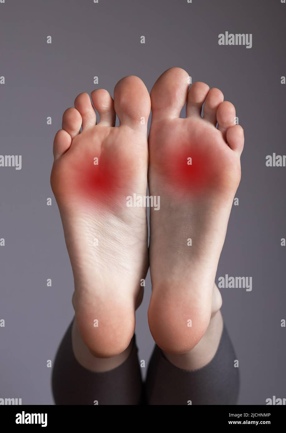 Arch pain, inflammation, overuse, plantar fascia injury. Foot with red points. High quality photo Stock Photo
