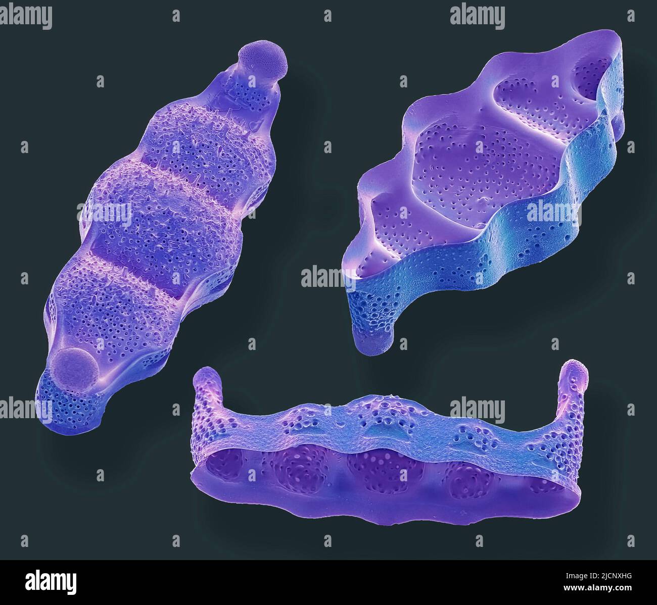Diatoms. Coloured scanning electron micrograph (SEM) of biddulphia sp
