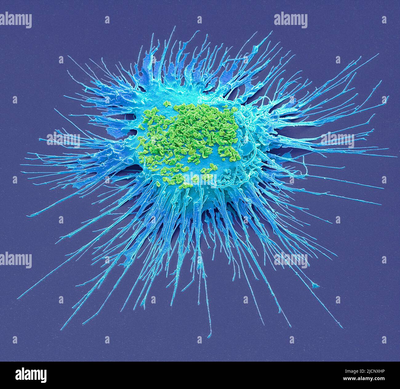 Mycoplasma. Composition coloured scanning electron micrograph (SEM) of