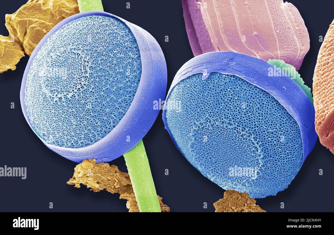 Diatoms. Coloured scanning electron micrograph (SEM) of melosira sp ...