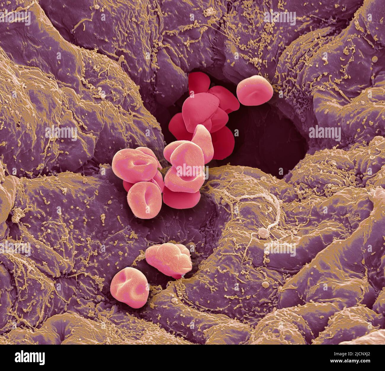 Blood vessel. Coloured scanning electron micrograph (SEM) of a blood ...