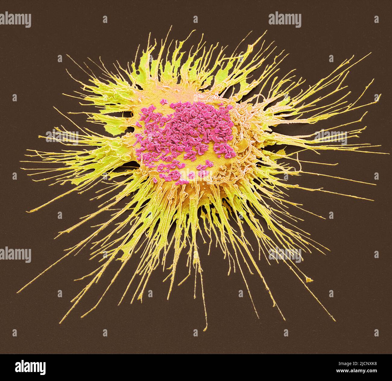 Mycoplasma. Composition coloured scanning electron micrograph (SEM) of
