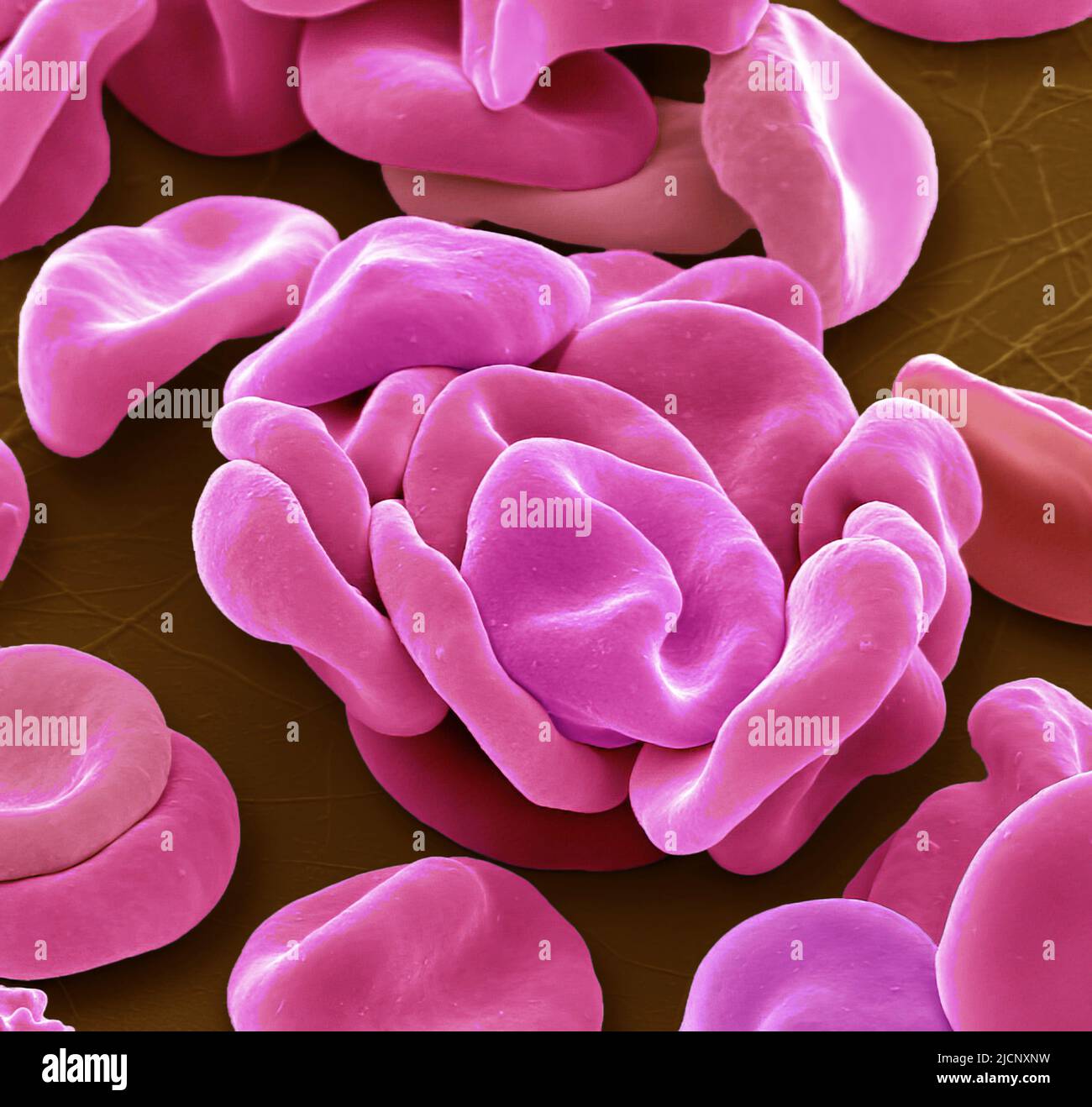 Red blood cells. Coloured scanning electron micrograph (SEM) of red ...