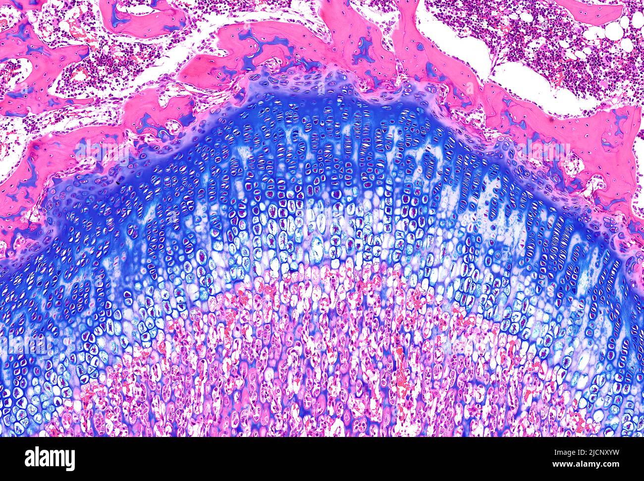 Light micrograph of an epiphyseal growth plate showing columns of
