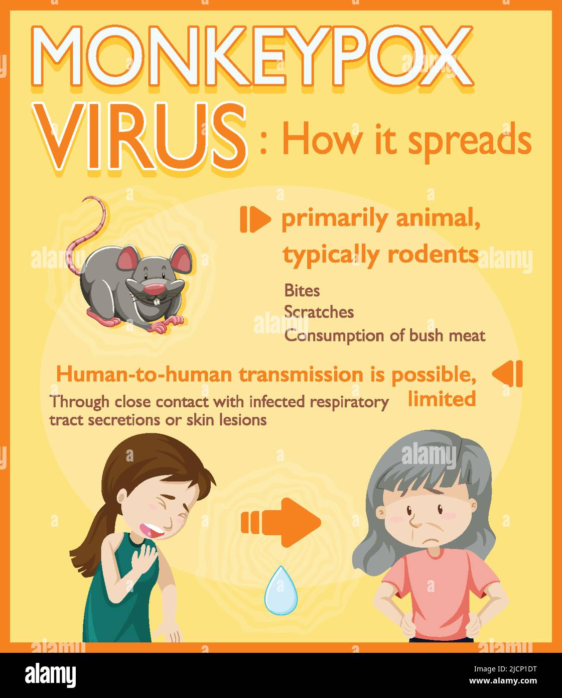 Monkeypox virus symptoms infographic illustration Stock Vector Image ...