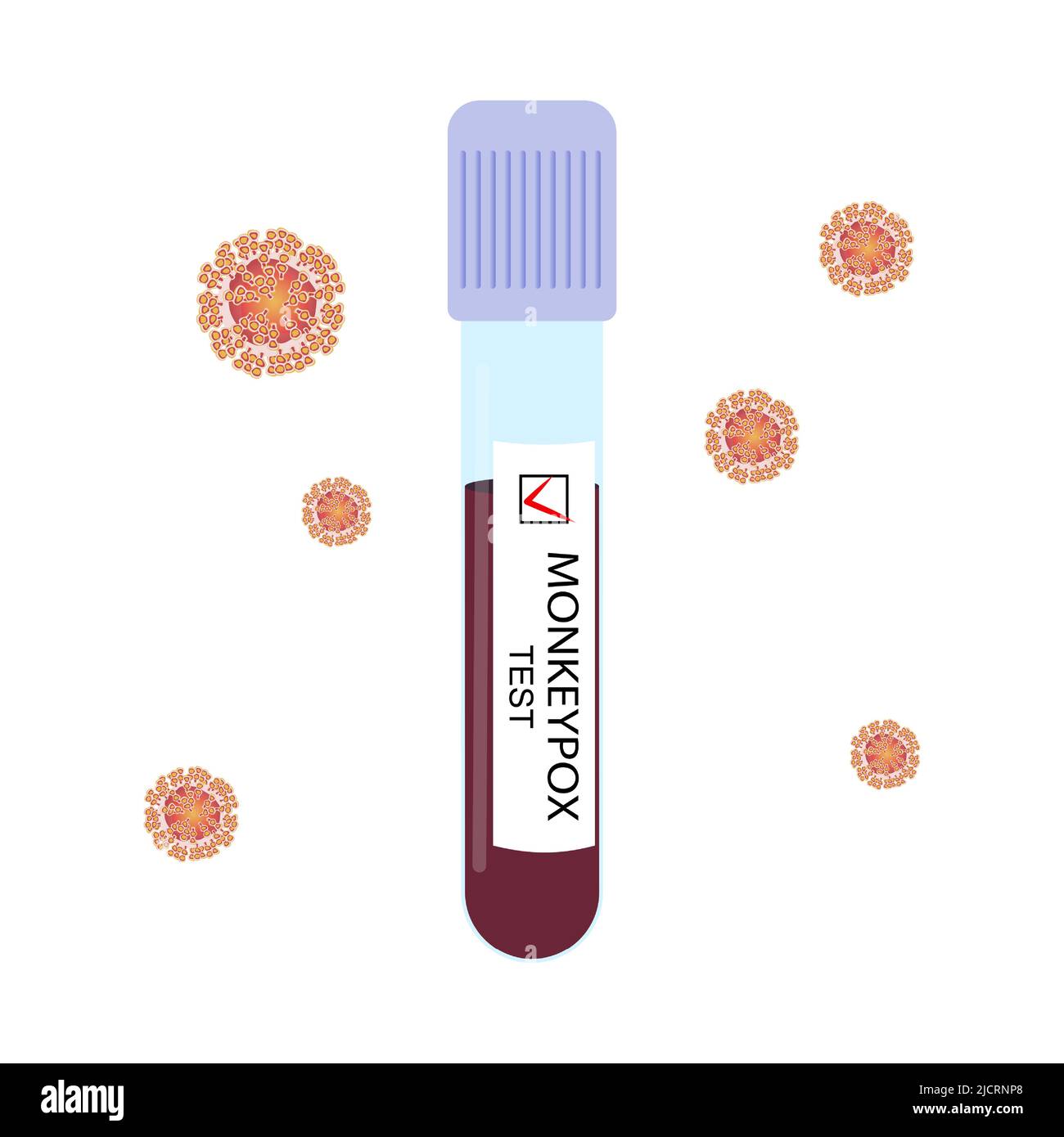 Test tube, blood sample with positive test for monkeypox virus and virus cells isolated on white background. Vector illustration. Stock Vector