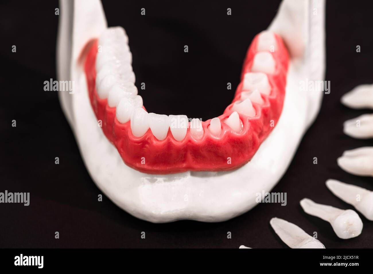 Teeth implant and crown installation process parts isolated on a black ...