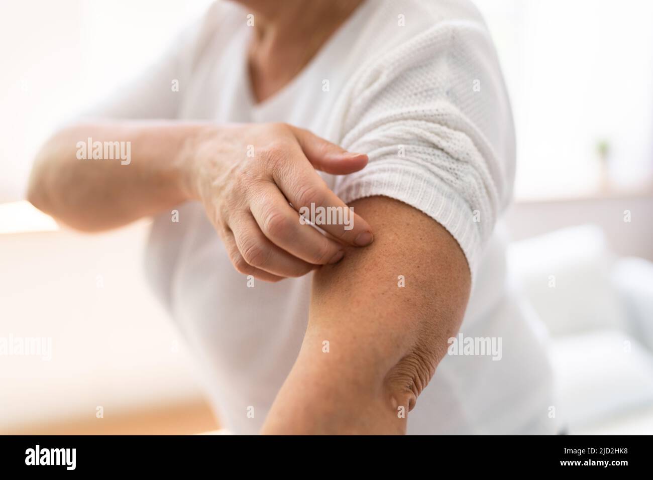 Woman Scratching Itching Body Skin With Allergy Stock Photo