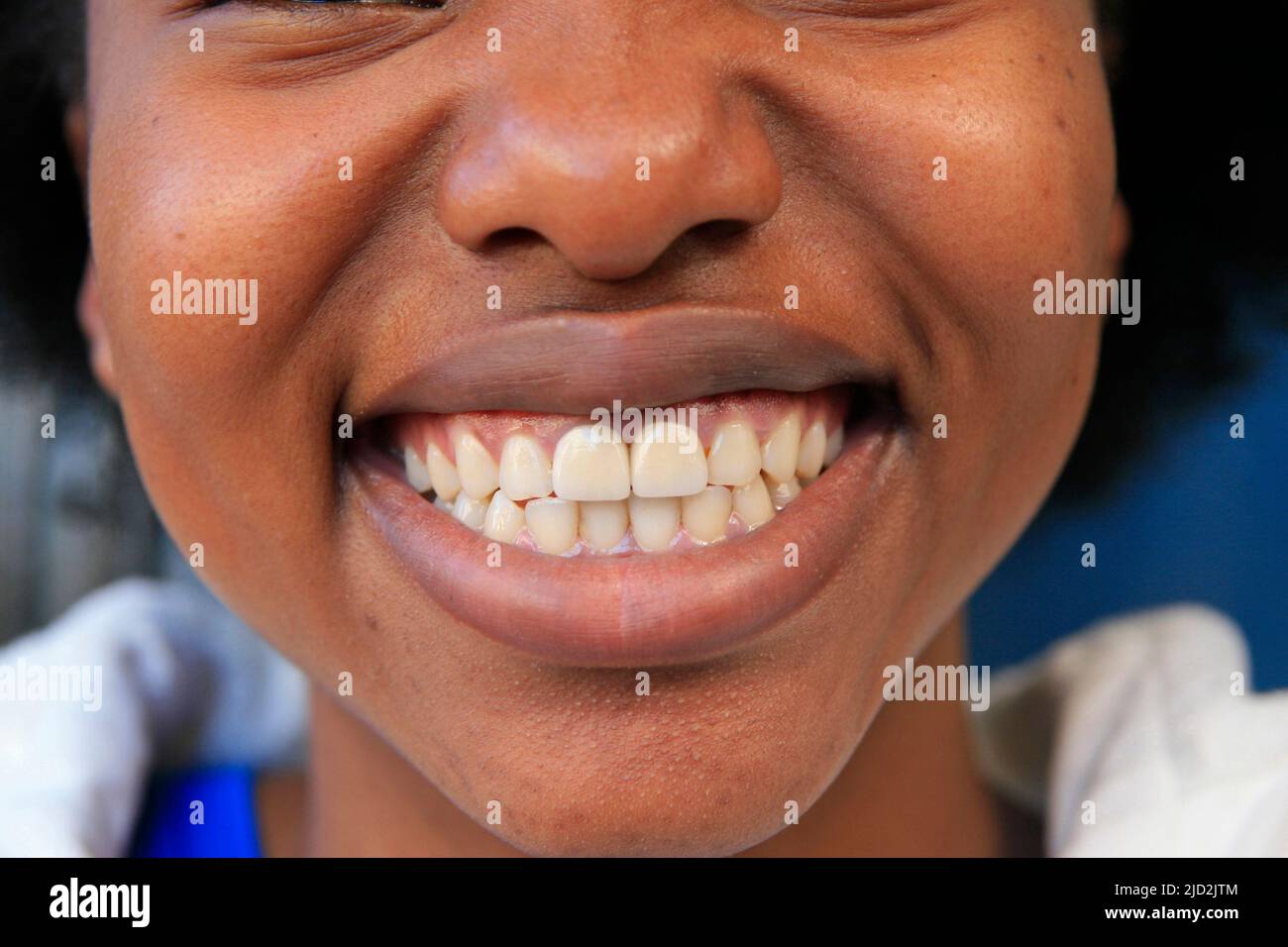 Close up of smiling African girl's face and teeth, Braamfontein, Johannesburg, Gauteng, South Africa. Stock Photo