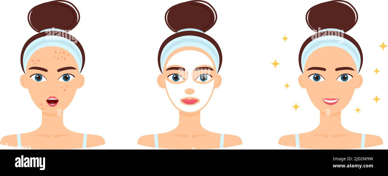 Young woman with acne. Treatment, before and after skincare. Face mask, beauty concept, vector illustration Stock Vector