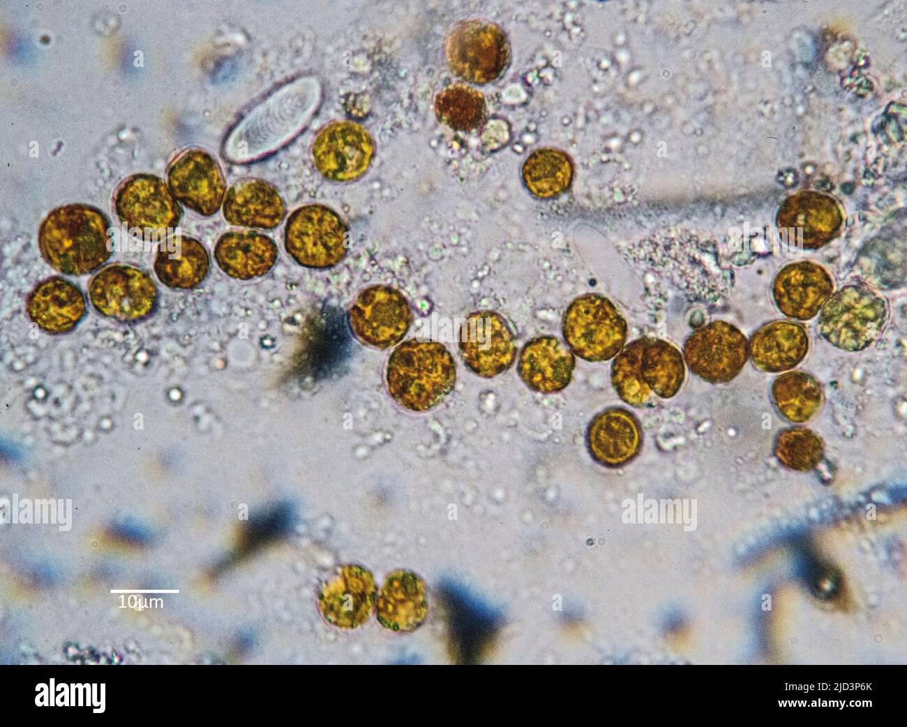 Symbiotic algae (zooxanthellae) from a zoanthid (Zoanthidea) from the Indo-Pacific. The individual cells are in average about 9 µm in diameter. Stock Photo