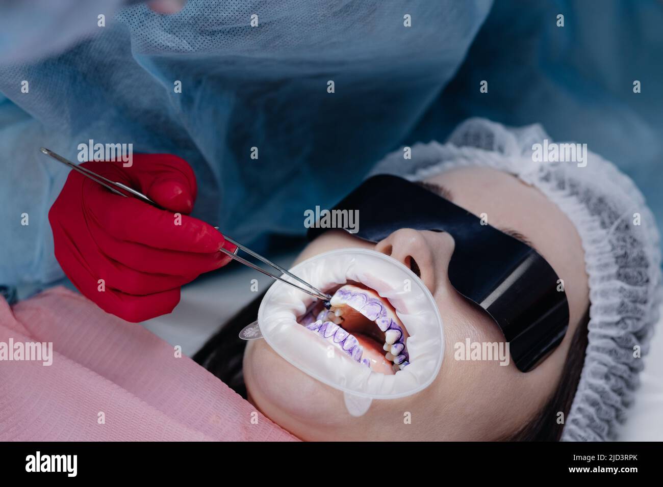 A female dentist with dental instruments applies the solution to the teeth in the office of the dental clinic. High quality photo Stock Photo