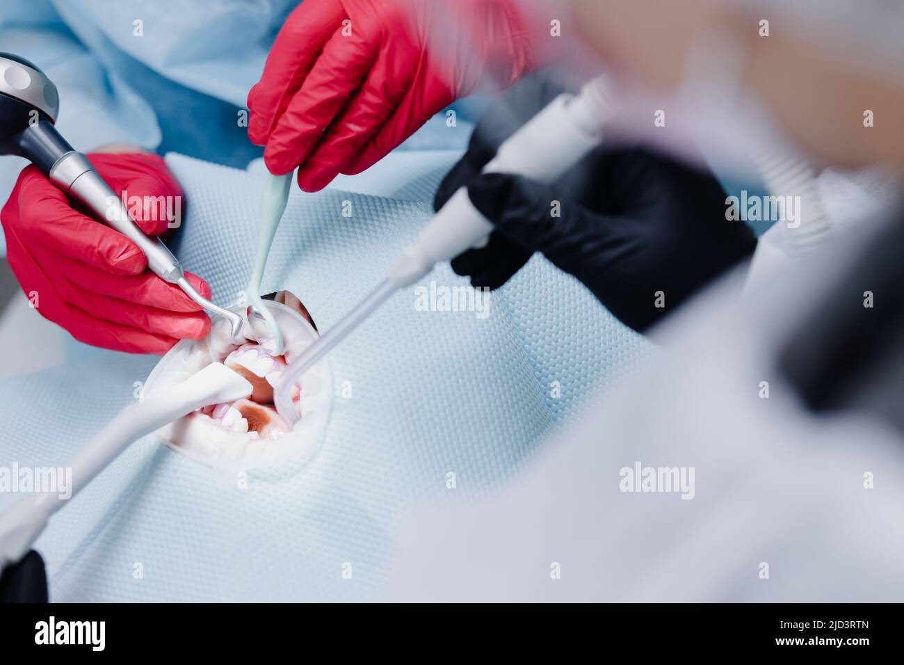 The process of brushing teeth in women close up in the dental office. The concept of healthy teeth. Close up. High quality photo Stock Photo