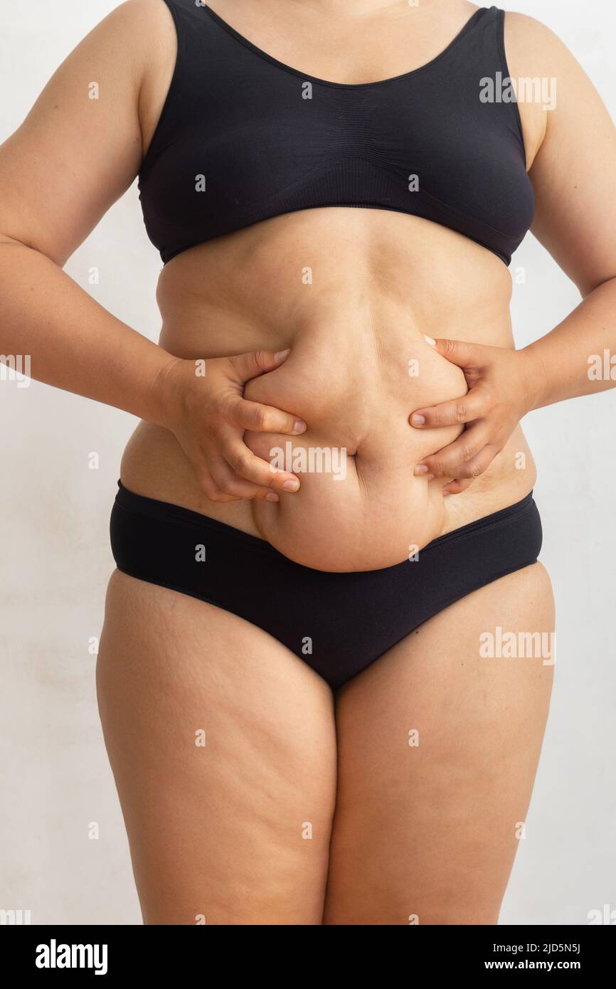 Cropped overweight fat woman in black bikini touching and squeeze sagging  abdomen. Getting rid of hanging belly, massage Stock Photo - Alamy