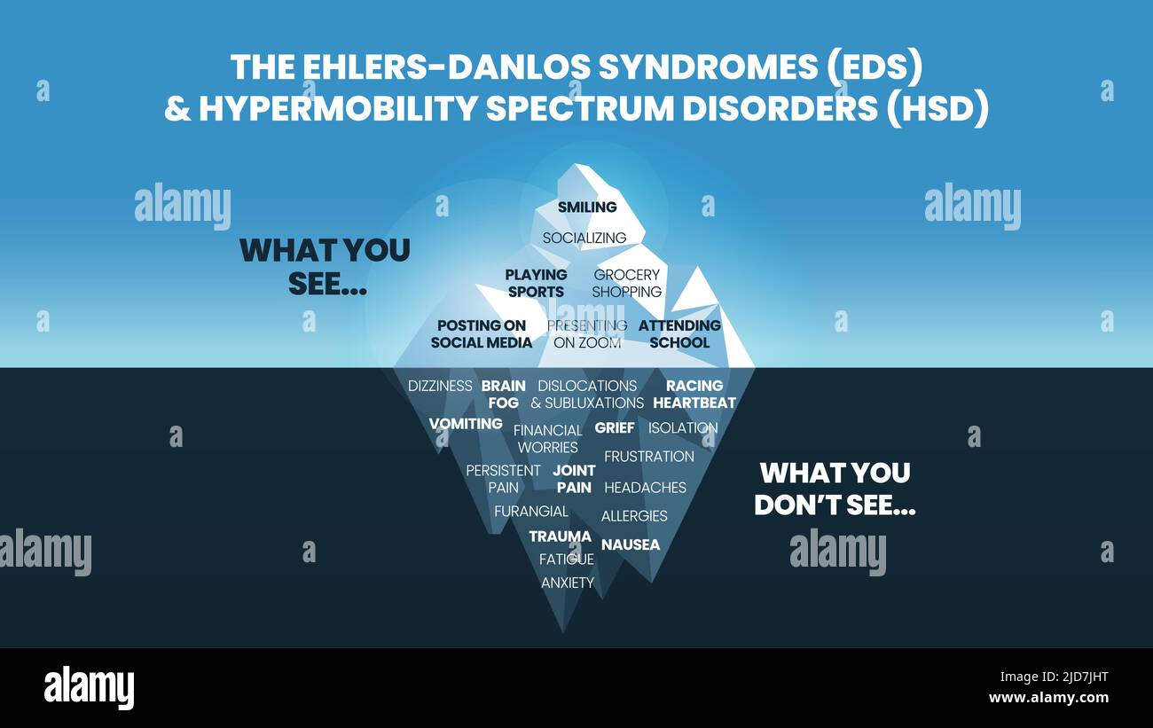The iceberg model of Ehlers-Danlos Syndromes (EDS) and Hypermobility spectrum disorder (HDS) concept has the surface symptom can see happy and normal Stock Vector