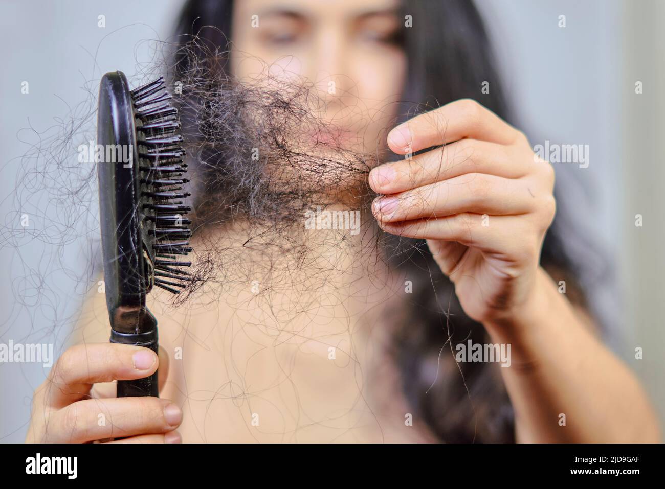 Hair Loss Health Issues: Unveiling Underlying Conditions
