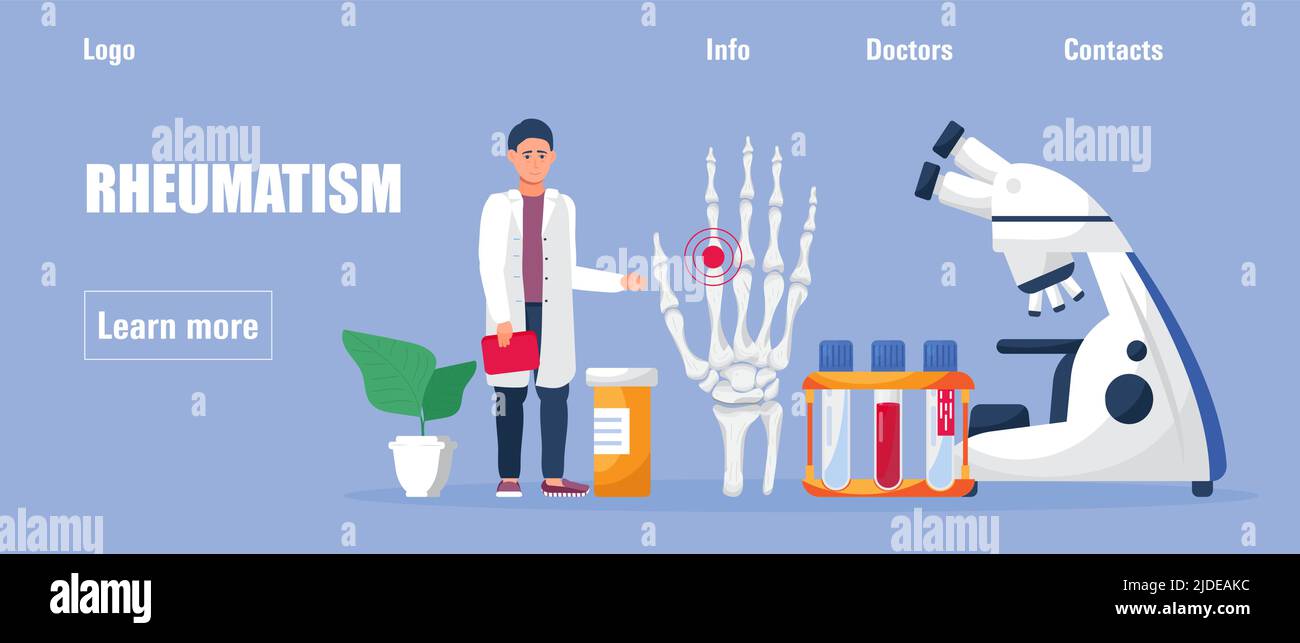 Rheumatoid arthritis of the hand. Tiny doctors treat rheumatism