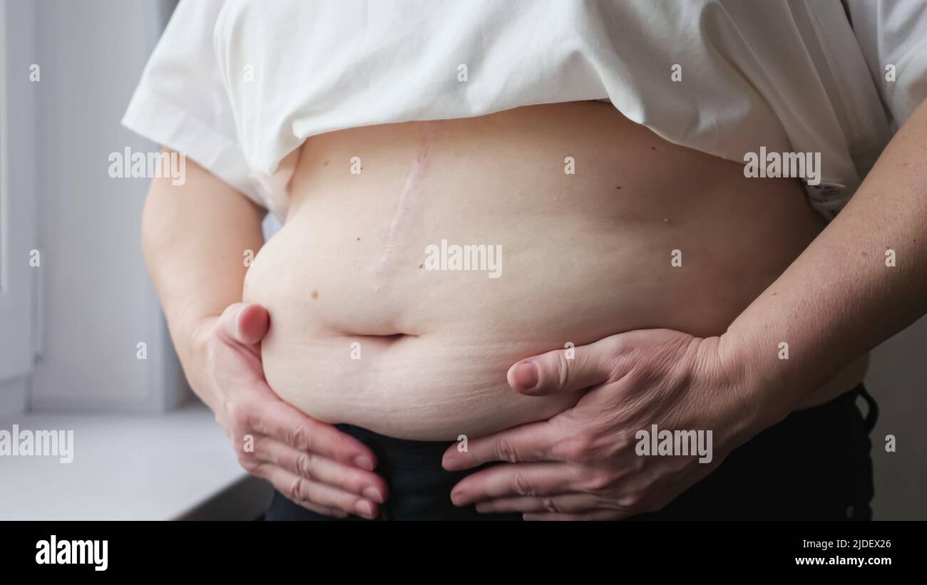 Mature woman strokes and squeezes fat belly near windowsill Stock Photo
