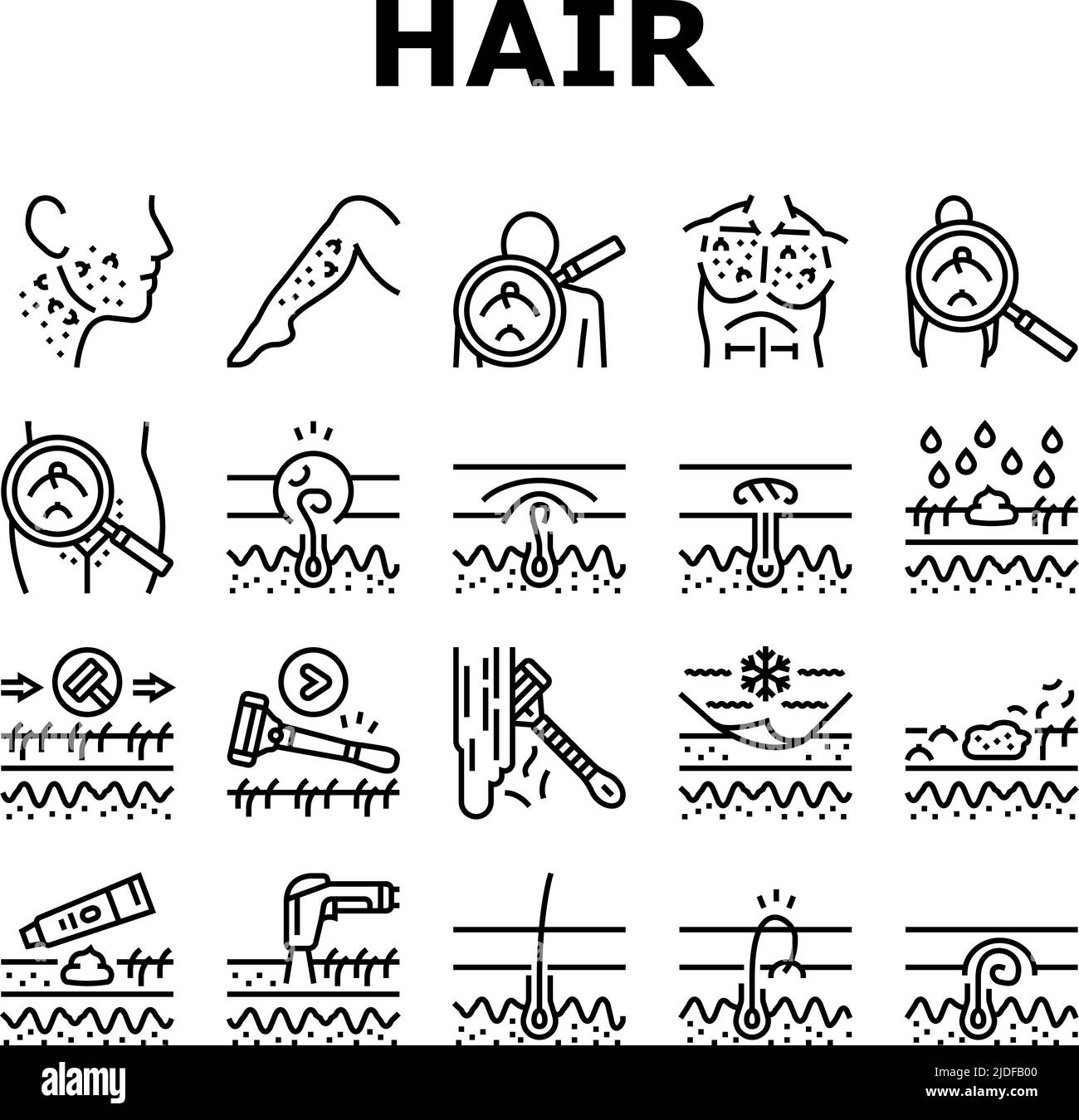 Ingrown Hair Problem Treatment Icons Set Vector Stock Vector Image ...