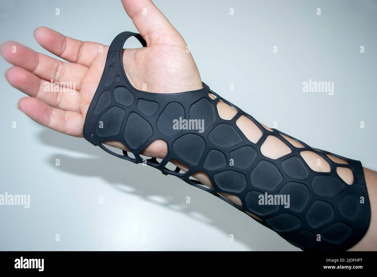 Orthopedic plastic prosthesis printed on powder 3D printer on hand