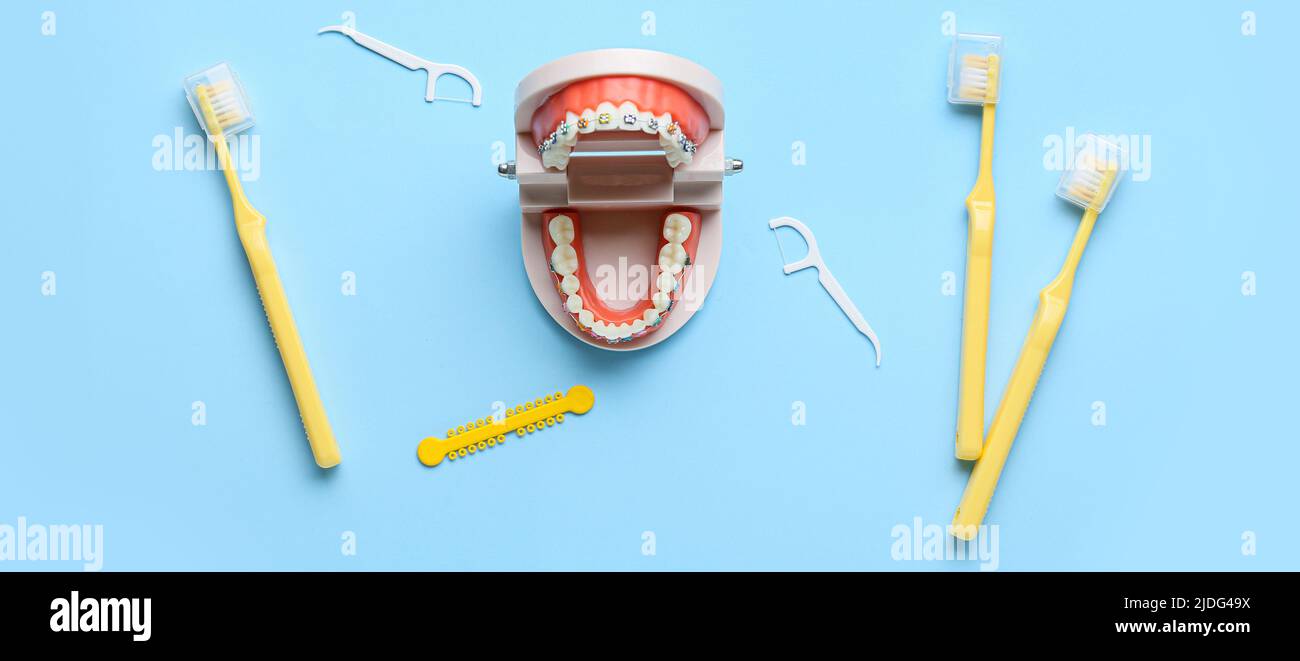 Model of jaw with dental braces, toothpicks and brushes on light blue