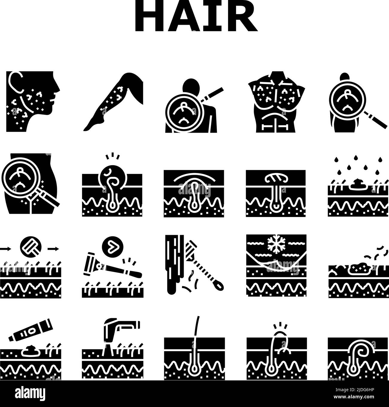 Ingrown Hair Problem Treatment Icons Set Vector Stock Vector Image ...