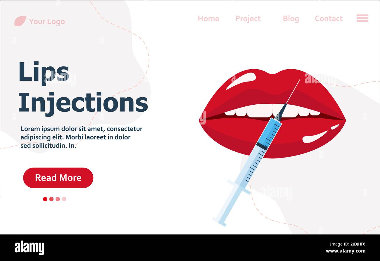 Modern vector illustration of lips injections. Lip augmentation ...
