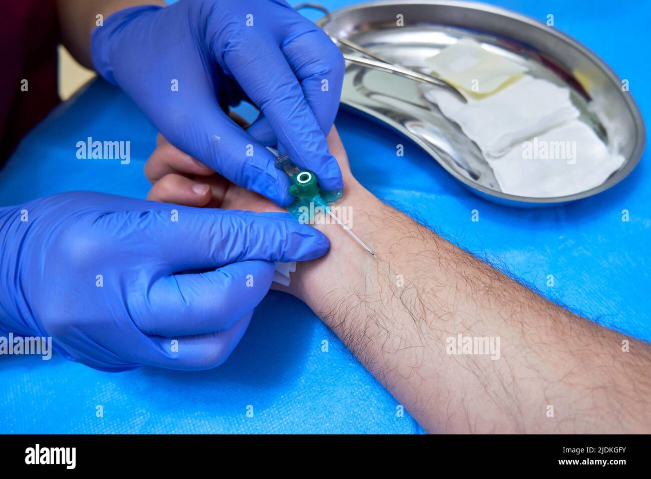 Preparation for vein catheterization. Intravenous catheter in doctor's