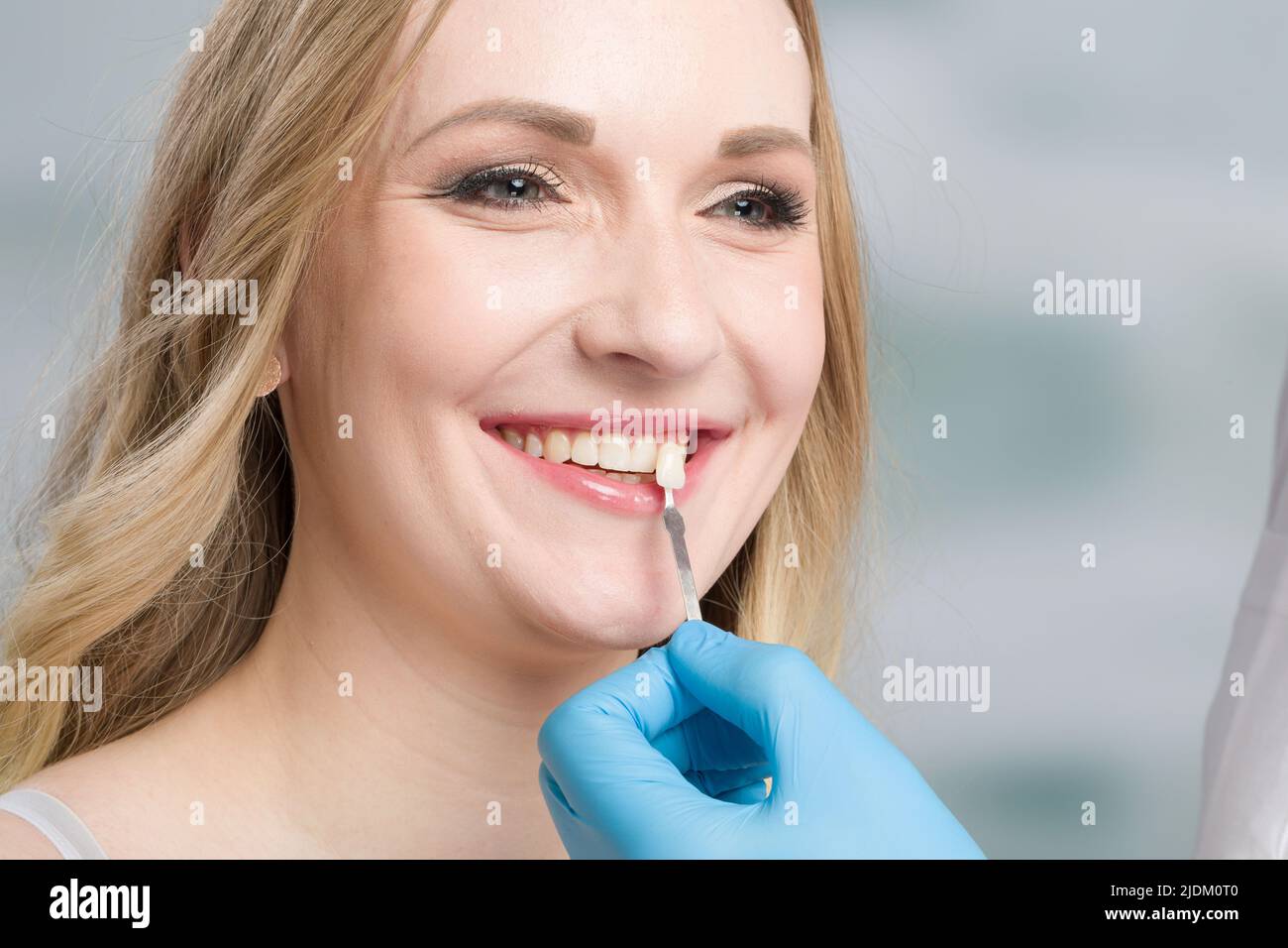 Close up of dentist using shade guide at woman's mouth to check shade