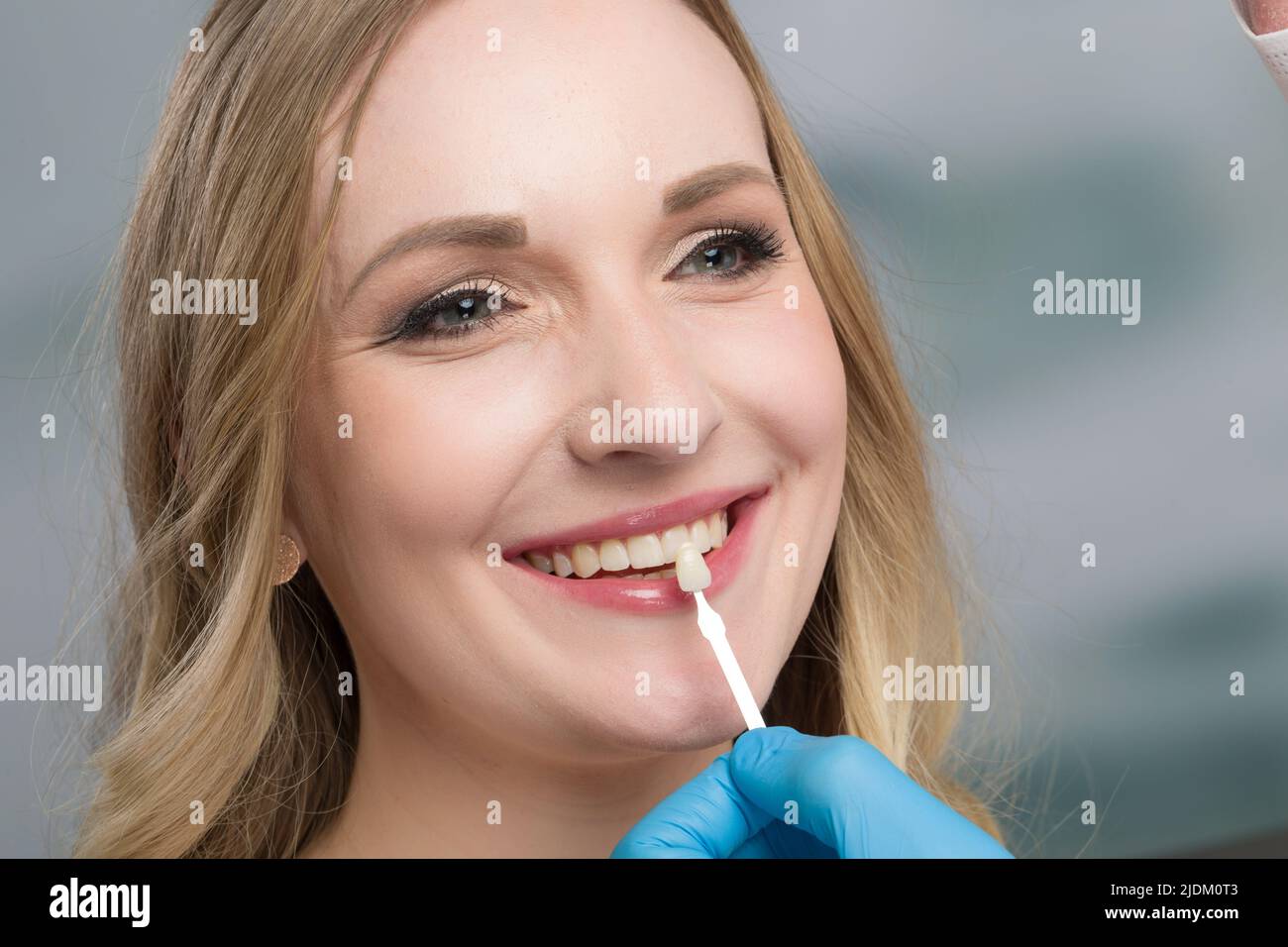 Close up of dentist using shade guide at woman's mouth to check shade