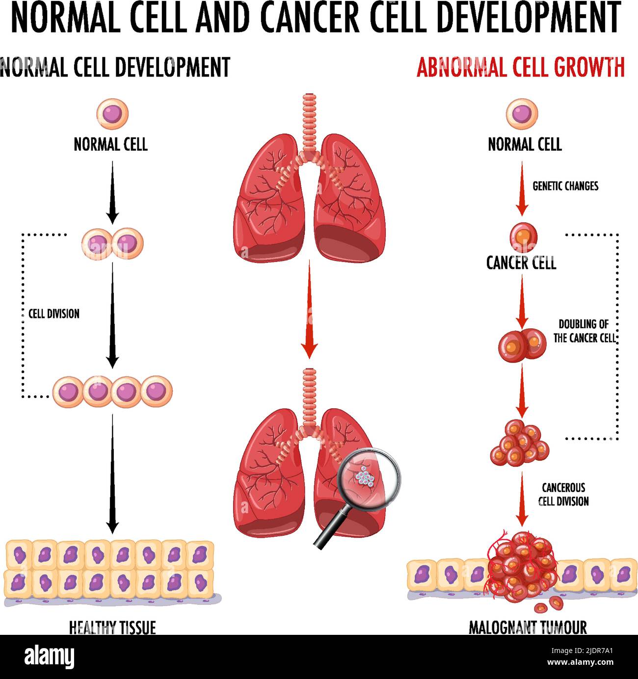 Diagram showing cancer development process illustration Stock Vector ...