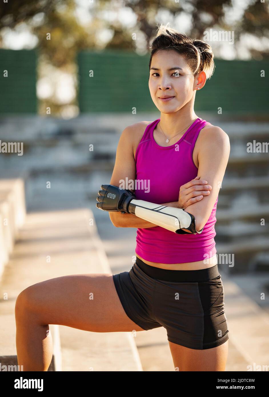 Prosthetic arms hi-res stock photography and images - Alamy