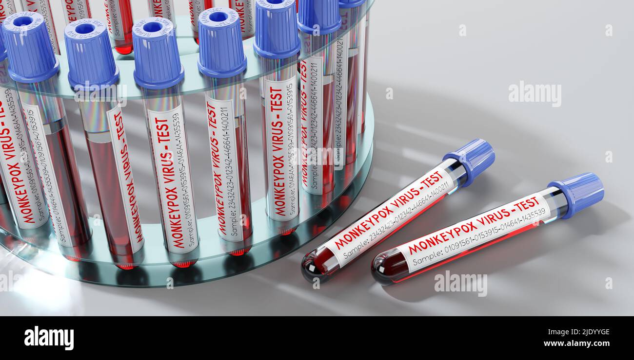 Monkey pox virus blood test vials 3D illustration Stock Photo Alamy
