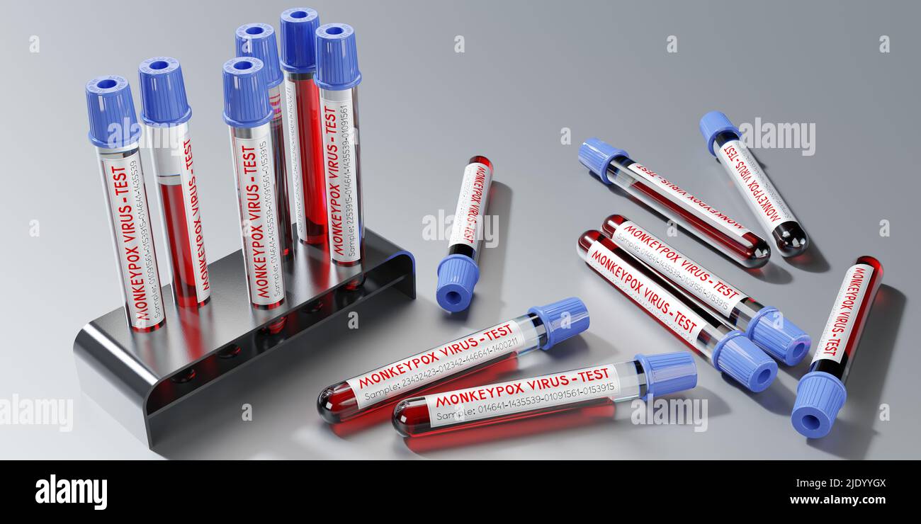 Monkey pox virus blood test vials - 3D illustration Stock Photo - Alamy