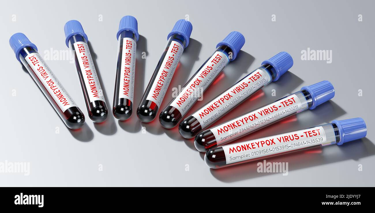 Monkey pox virus blood test vials - 3D illustration Stock Photo - Alamy