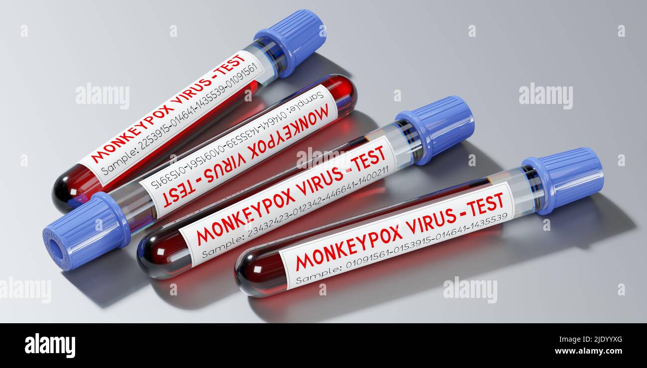 Monkey pox virus blood test vials - 3D illustration Stock Photo - Alamy