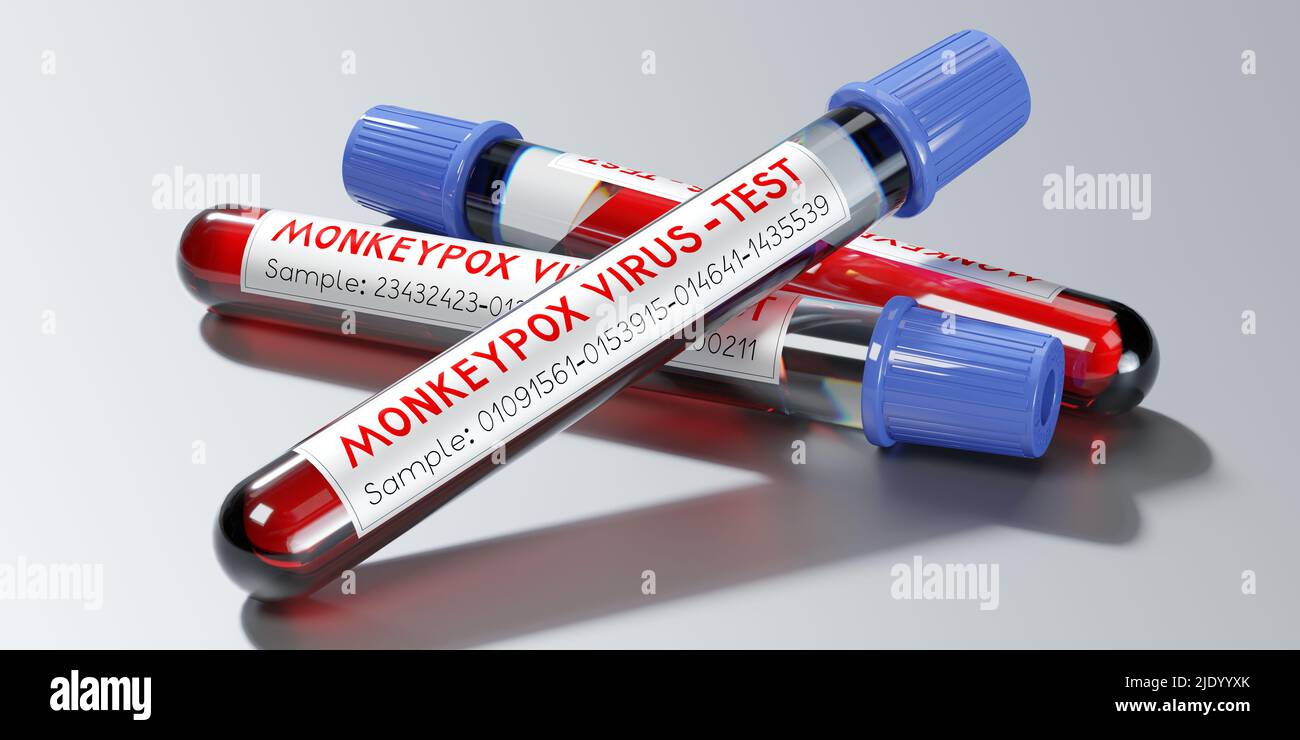Monkey pox virus blood test vials - 3D illustration Stock Photo - Alamy
