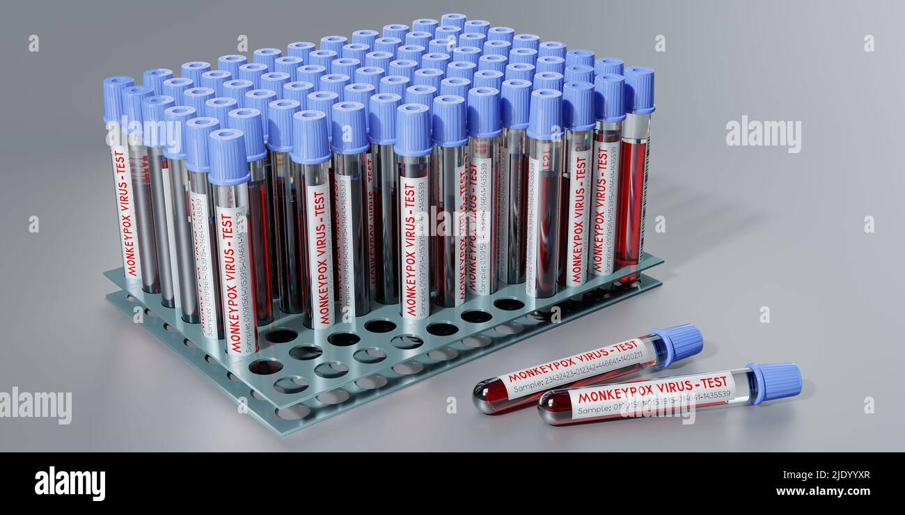 Monkey pox virus blood test vials - 3D illustration Stock Photo - Alamy