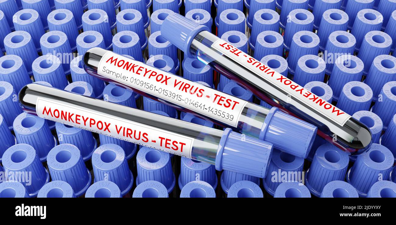 Monkey pox virus blood test vials - 3D illustration Stock Photo - Alamy
