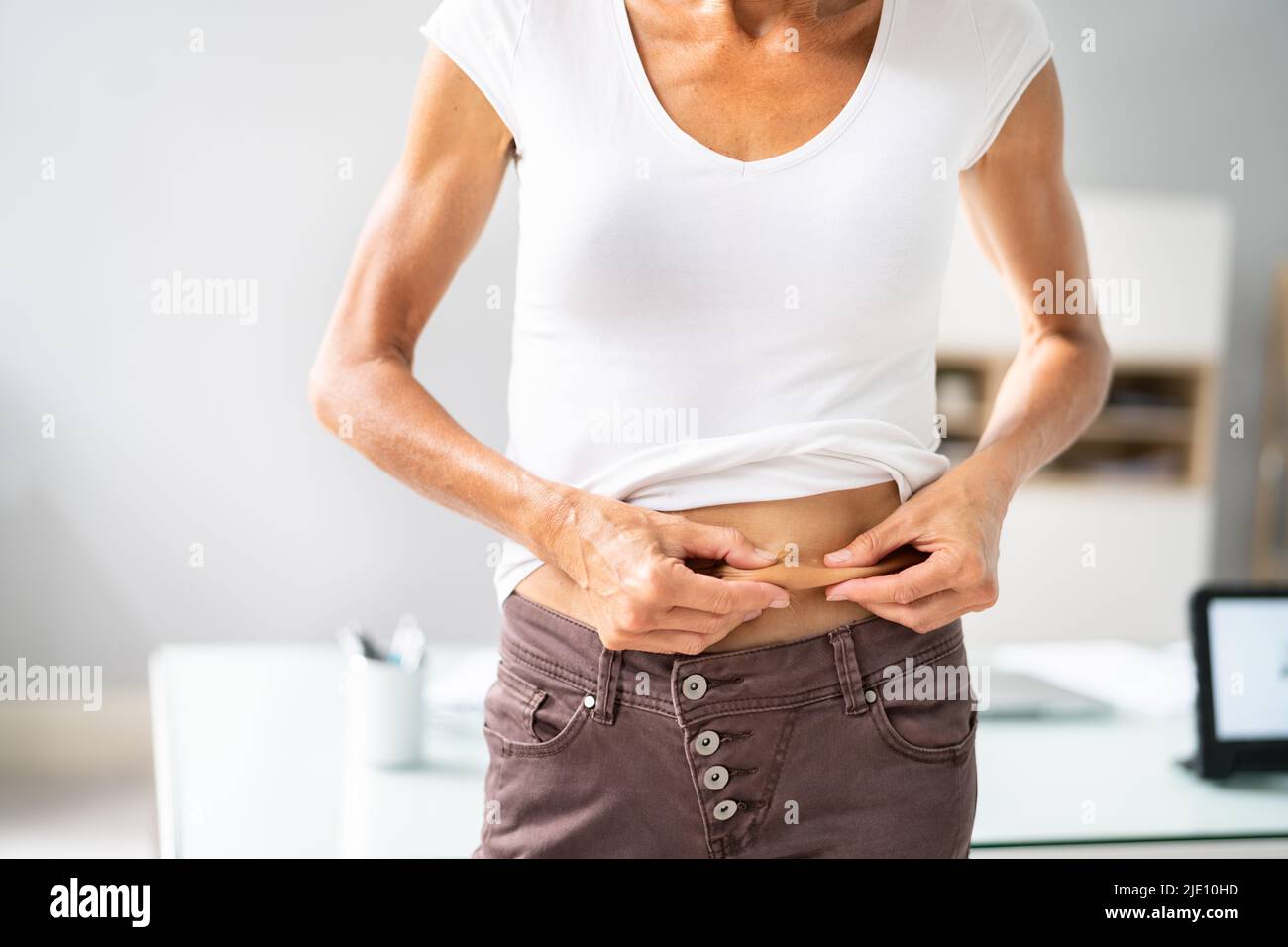 Stomach Fat Liposuction And Diet. Stomach Skin Pinch Stock Photo